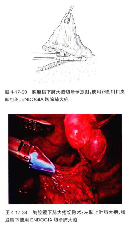 33.png