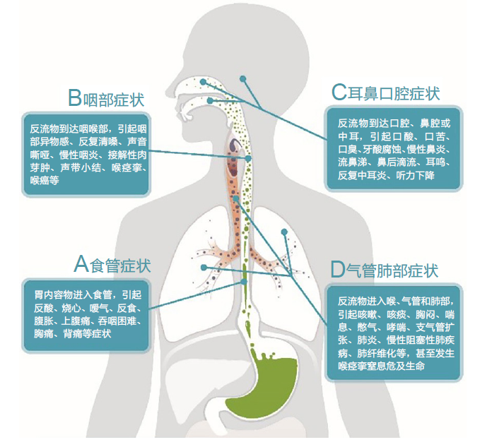 ee3748fc088d3d576e5719f38c6e46c8.png